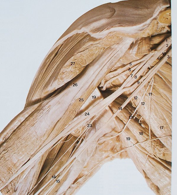 Plexus brachialis von ventromedial